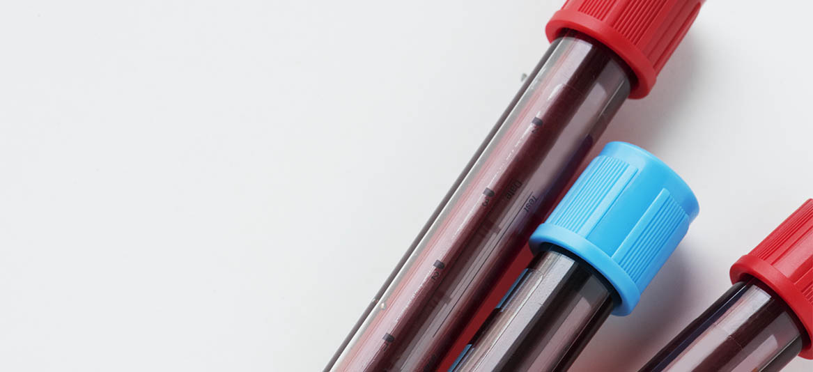 benefícios das atividades físicas